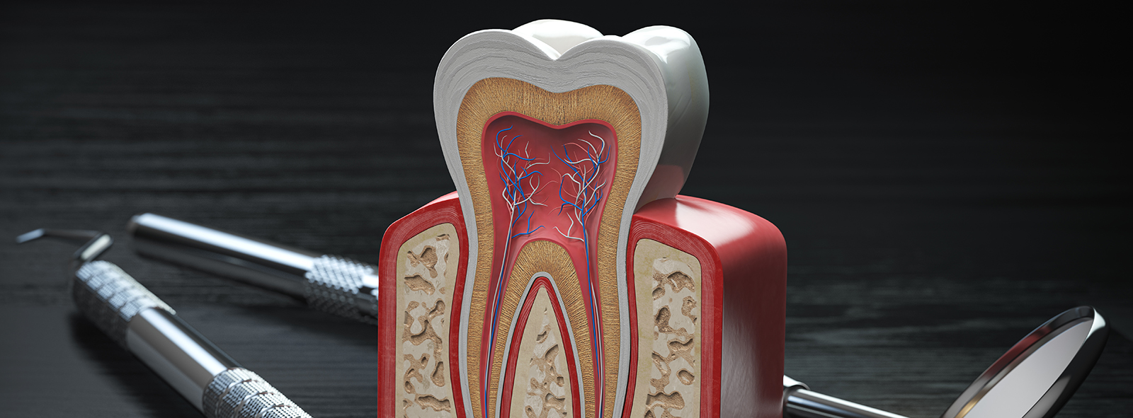 Root Canal Treatment